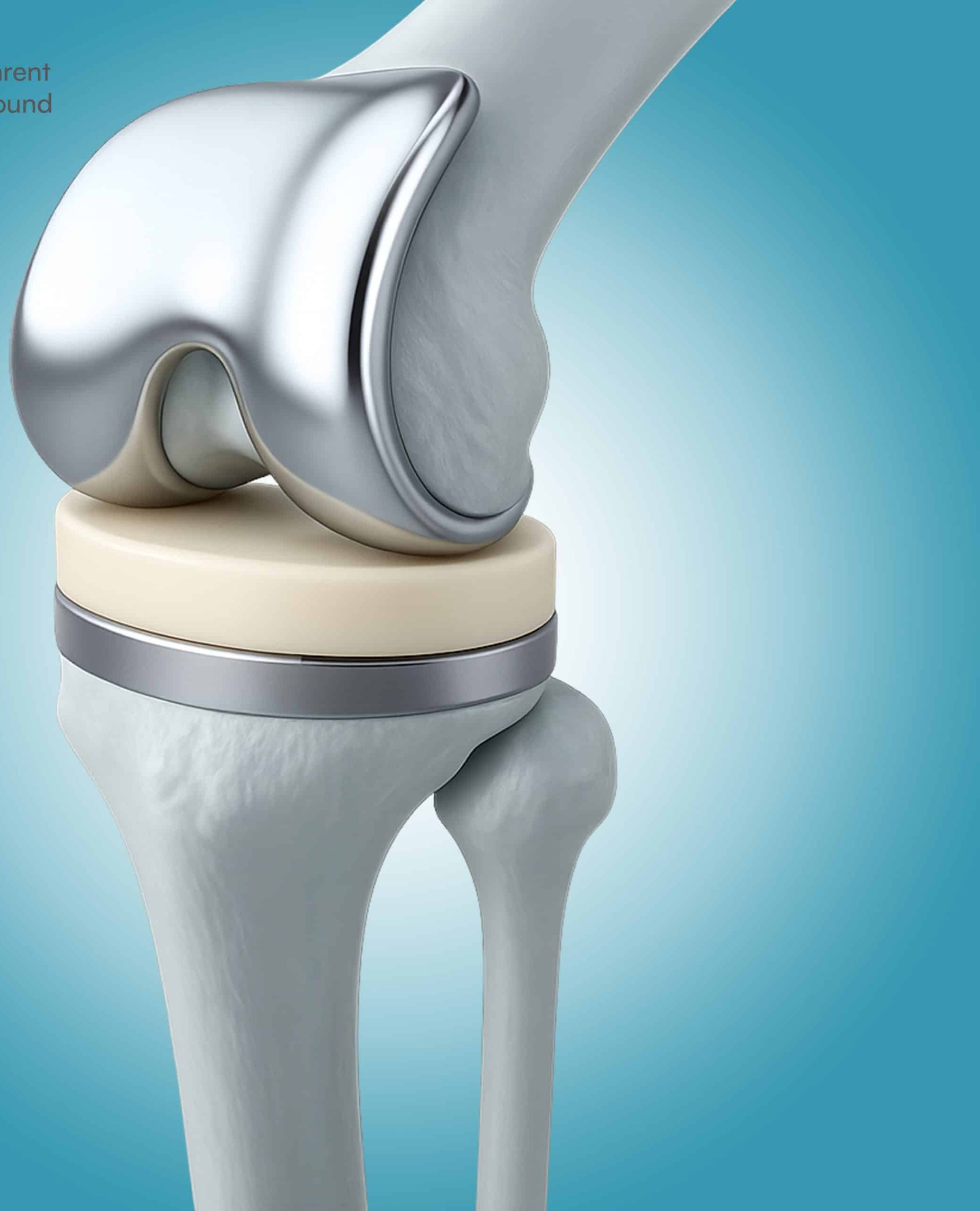 Ortopedi ve Travmatoloji Prof. Dr. Kerem Canbora