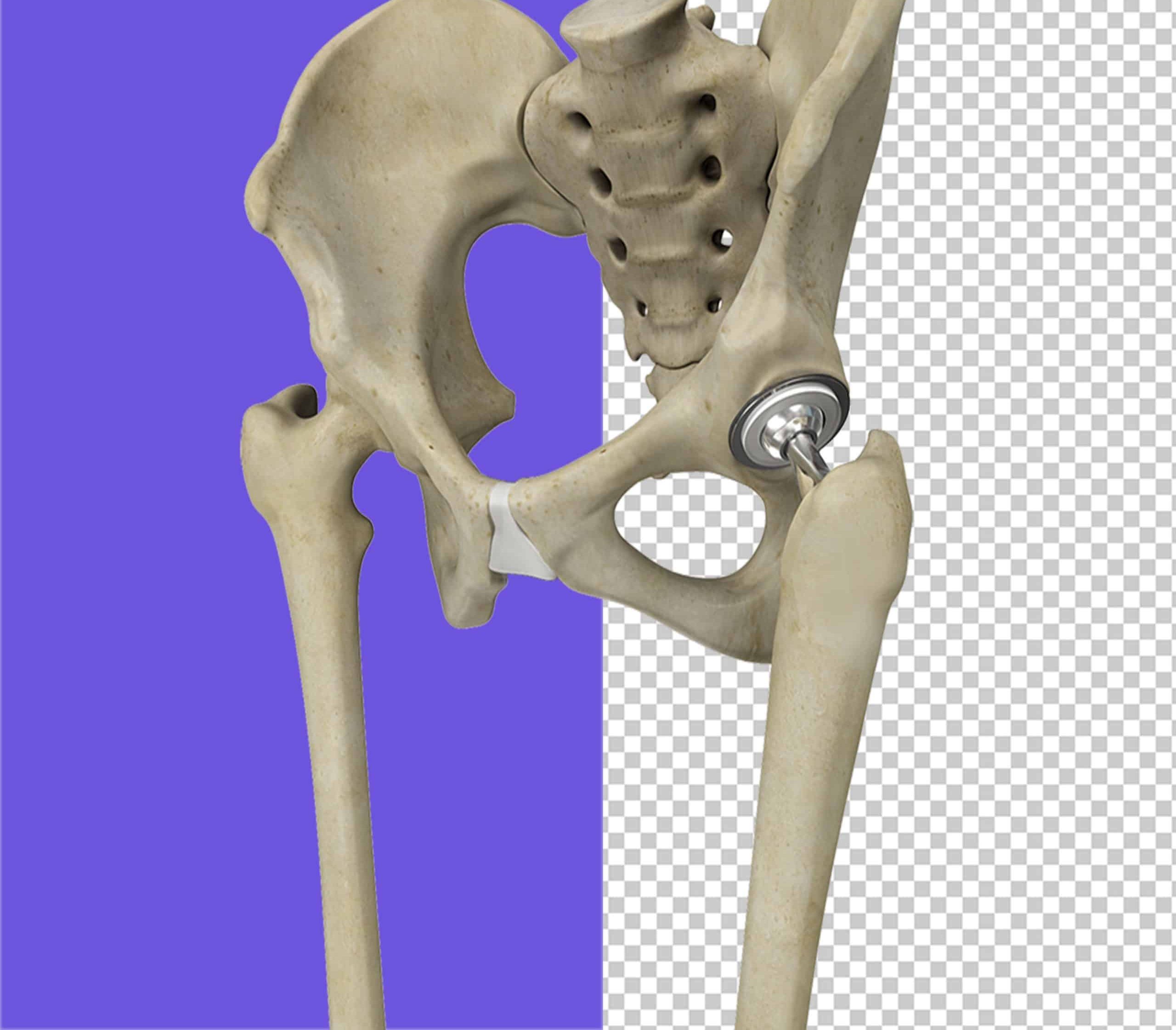 Ortopedi ve Travmatoloji Prof. Dr. Kerem Canbora